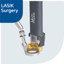 LASIK M2 Single Use